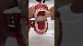 How to Brush your teeth when you have Braces on braces brush [upl. by Sheba449]