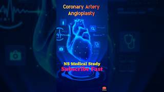 Angiography VS Angioplasty Surgery  Doctor life  viralvideo doctor shorts [upl. by Llerdnam]