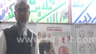 Hijama Benefits for Head part 2 [upl. by Ardnuasal]