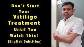 Don’t Start Your Vitiligo Homeopathy Treatment Until You Watch This [upl. by Ademla]