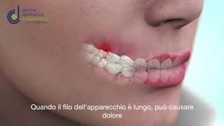 TUTORIAL TAGLIARE FILO APPARECCHIO FISSO [upl. by Beach982]