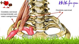 Saúde  Sintomas e tratamento da costela cervical [upl. by Nnyletak]