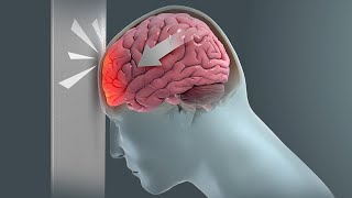 How Traumatic Brain Injury TBI Affects Brain Cells  New Research Could Lead to New Treatments [upl. by Aliehs851]