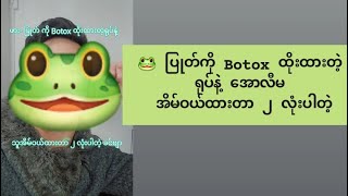 🐸 ပြုတ်ကို Botox ထိုးထားတဲ့ ရုပ်နဲ့​အောလီမ အိမ်ဝယ်ထားတာ ၂ လုံးပါတဲ့ [upl. by Yrreiht]