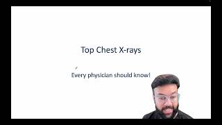 Top 8 Essential Chest XRay Findings Every Physician Should Know  Radiology Basics  USMLEStrike [upl. by Cherie]