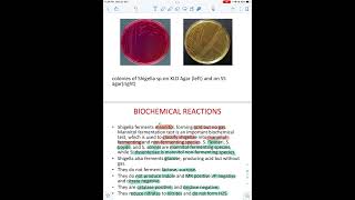 Practical microbiology shigella [upl. by Maiah]