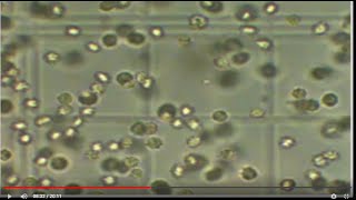 How to count Rbcs amp Wbcs content using Hemocytometer [upl. by Schroder]