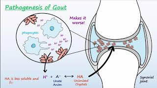 Gout  Mechanisms amp Treatment [upl. by Odnumyer946]