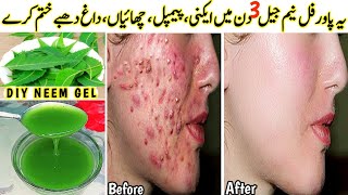 I applied👆🏻this DIY Neem Gel on Acne Pimples PigmentationBumps  Got Clear Glowing Skin In 3 Days [upl. by Januisz]