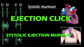 Ejection Click And Systolic Ejection Murmur pf Heart Sound [upl. by Yliram]