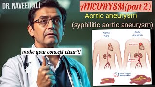 Aneurysm  Aortic aneurysm  Syphilitic aortic aneurysm  Thoracic aortic aneurysm  part 2 [upl. by Ahsoem]