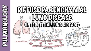 Advice for Living with Pulmonary Fibrosis [upl. by Etan]