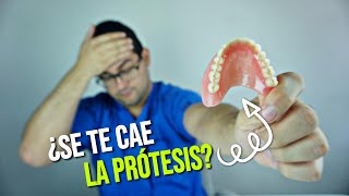 ¿TU PRÓTESIS DENTAL SE MUEVE😞 ¡Deberías ver este vídeo🤩 [upl. by Tinya647]