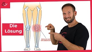 Nr 1 Übung bei Knieschmerzen  Das werden deine Knie lieben [upl. by Fauman345]