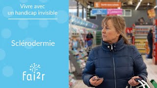 Vivre avec un handicap invisible  La sclérodermie mon quotidien [upl. by Laurette]