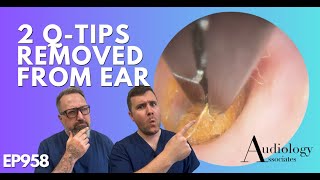 2 QTIPS REMOVED FROM EAR  EP958 [upl. by Ocirederf246]