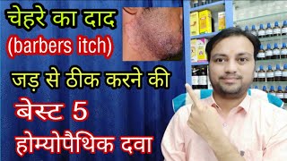 best 5 homeopathic medicine for barbers itch how to cure barbers itch easily in hindi fungal beard [upl. by Shandra819]