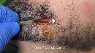 PELO ENCARNADO [upl. by Medin]