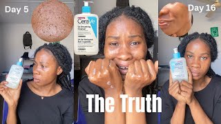 I TRIED CeraVe SA Smoothing Cleanser for 30 Days and This Happened Honest Review [upl. by Barthol]