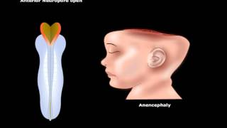 USMLE® Step 1 Neuroscience Development of CNS Animation [upl. by Zerline145]