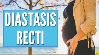 Diastasis Recti What is it How to Fix it Science Based [upl. by Eluj]