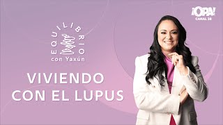 En Yaxún Tendremos el testimonio de Sofia Parissos quien nos cuenta cómo ha sido su vida con lupus [upl. by Yks492]