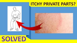 How To Cure Itching Near Private Parts  Itchy Groin Area Home Remedy [upl. by Etterb317]