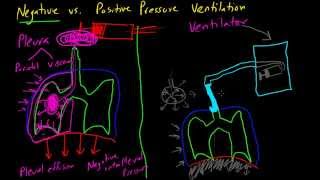 Negative vs Positive Pressure Ventilation [upl. by Montford854]