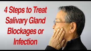 4 Steps to Treat Salivary Gland Swelling at Home [upl. by Wakeen]