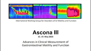 Ascona III  Oropharyngeal swallow I Pharyngeal  High Resolution Motility PHRM [upl. by Nerrual]