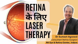 Retina का LASER treatment क्यों करते हैं  कब और कैसे करते हैं [upl. by Ayram104]