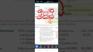 Biochemistry purine synthesis and salvage deficiencies [upl. by Meyers589]