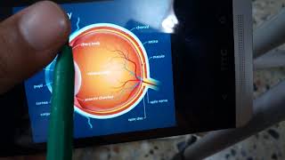 BACTERIAL CORNEAL ULCER made simple part 6 Complications of ulcer verry important [upl. by Orgell]