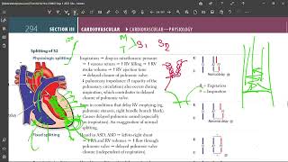 16 Demystifying Physiological Splitting of S2  Heart Sound Explained PhysiologicalSplitting [upl. by Sualkin]