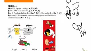 USMLE shortcuts Brainstem death tests2 details [upl. by Ahsienroc]