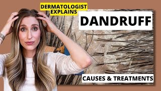 Dermatologist Explains Dandruff What Causes it amp Best Dandruff Treatments  Dr Sam Ellis [upl. by Sass278]