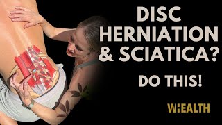 Disc Herniation and sciatica relief exercises [upl. by Stepha699]