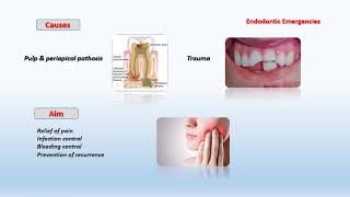 Fall 2020  Endodontic 3  Lec 5  Endodontic emergencies [upl. by Ern79]