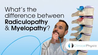 What’s the difference between Radiculopathy and Myelopathy  Expert Physio Guide [upl. by Yevol]