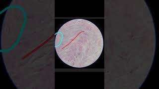 White Fibrocartilage Histology Anatomy 1st year MBBS [upl. by Alak]