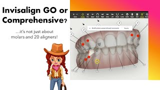 Invisalign ClinCheck Choosing between iGo vs Comprehensive  IPR tips [upl. by Schonfield]