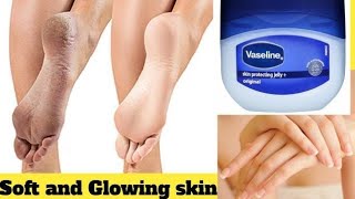 DIY Hand and Feet Whitening  Vaseline for hand and feet whitening  Vaseline remedy for Crack heels [upl. by Alamat]