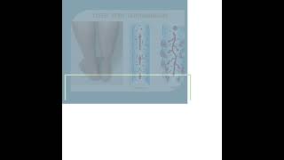 Ultrasound  The Foremost Noninvasive Method for Diagnosing Deep Vein Thrombosis DVT [upl. by China]