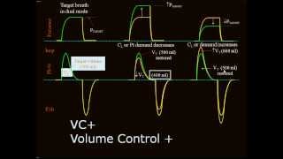 Mechanical ventilation 12 Auto flow English [upl. by Ardyce]