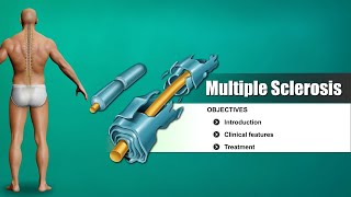 Multiple sclerosis  causes symptoms diagnosis treatment pathology [upl. by Idnahc235]