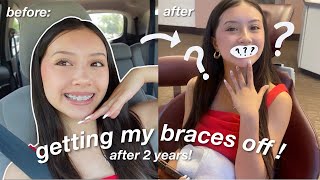 GETTING MY BRACES OFF 😁 [upl. by Tibbitts]