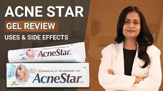 Acnestar gel review  Acnestar gel  Acne star for Acne amp Pimples  Acnestar gel use amp side effects [upl. by Daphne]