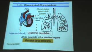 DrAzza  Parasitology  Nematodes 4  quotstrongyloides stercoralis  capillaria philippinensisquot [upl. by Sihtnyc985]