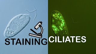 Staining Ciliates for fluorescent microscopy [upl. by Ahsiatal]