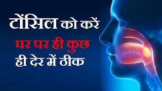 टॉन्सिल्स के घरेलू उपचार Gharelu Upchar for Tonsils in Hindi  Tonsil Home Remedies [upl. by Levins]